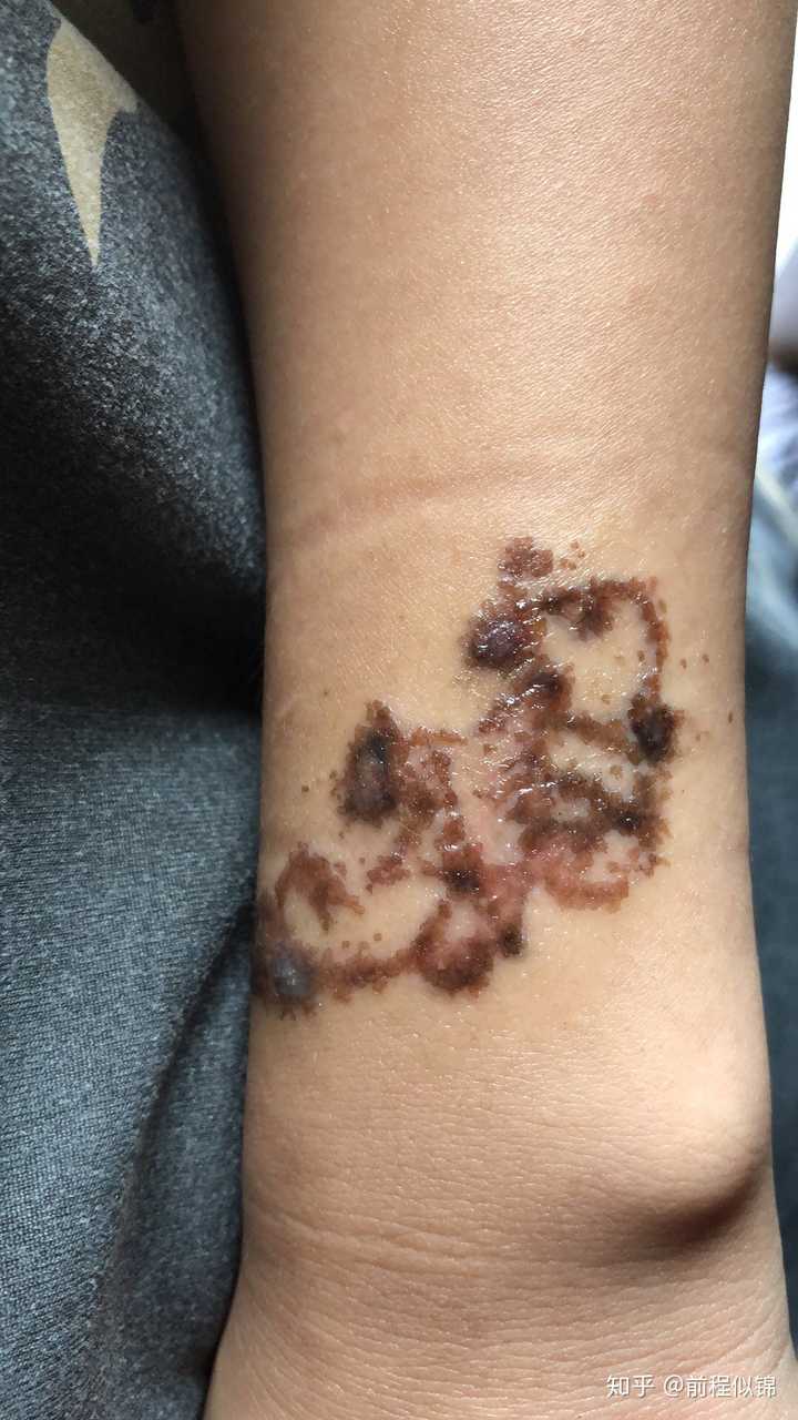 纪念我洗纹身的过程?