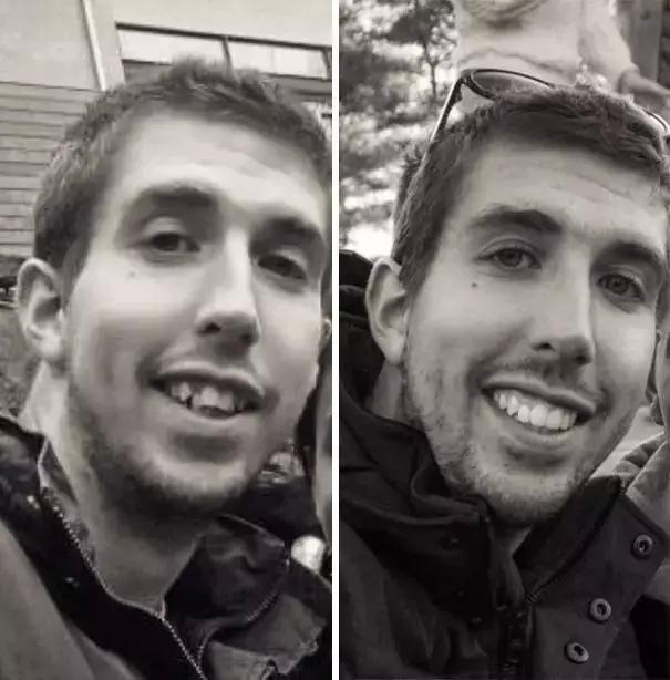 外国人对牙齿特别重视,在美国,无论是穷人还是富人,都很看重牙齿健康