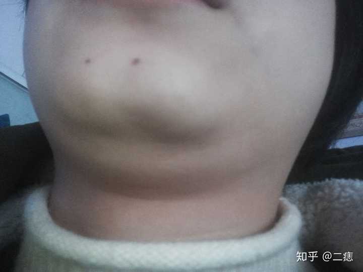女生有个屁股下巴是种怎样的体验?