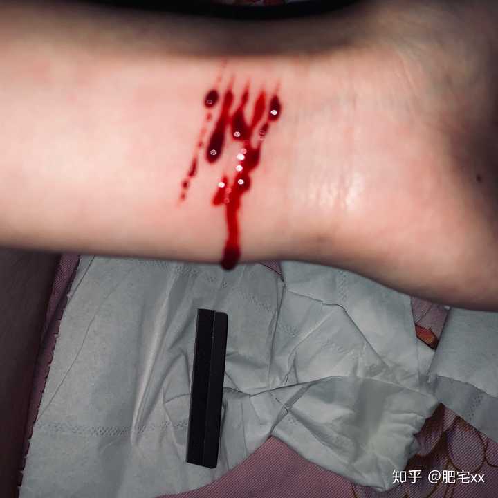 抑郁症患者最不想听到别人对他(她)说什么?