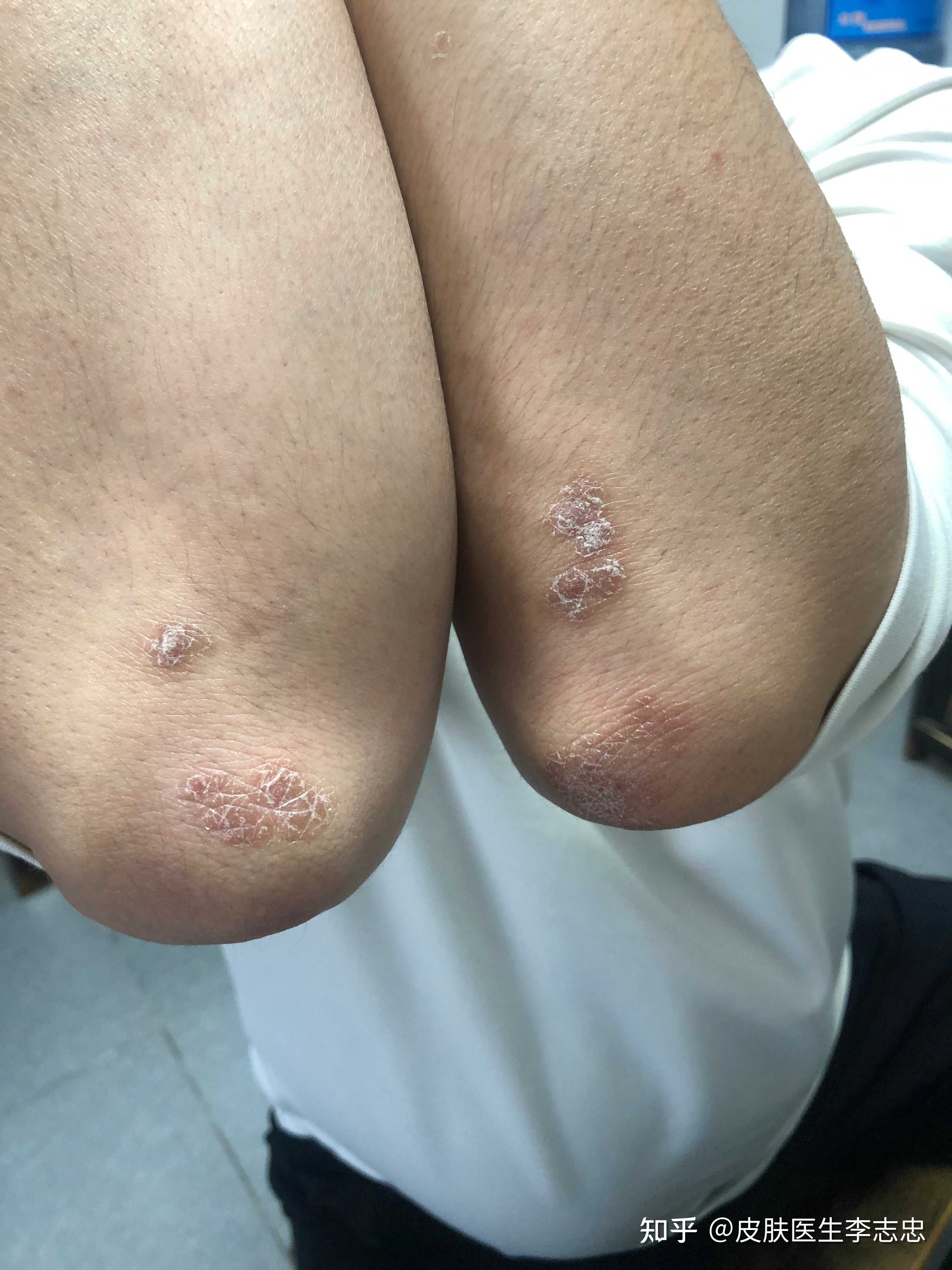 皮肤医生李志忠