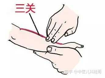 中医还有很多外治的方法,都可以在家帮助患儿有效退热比如中药药浴