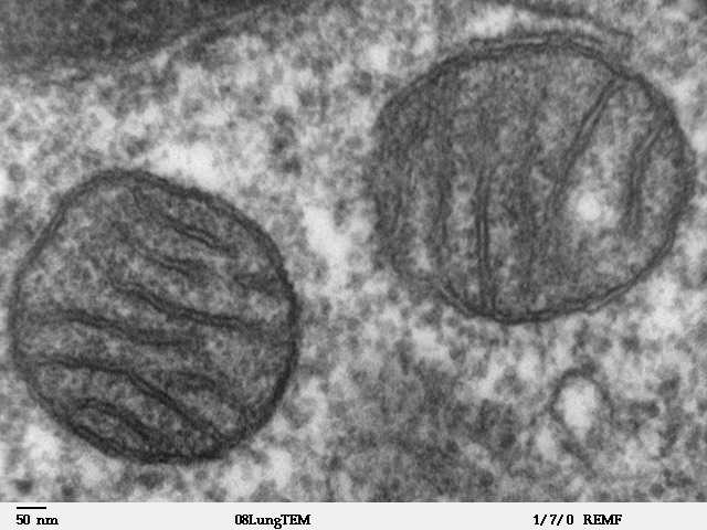 中心体在光学显微镜下可见吗中心体不是由微管蛋白组成其大小为何可见