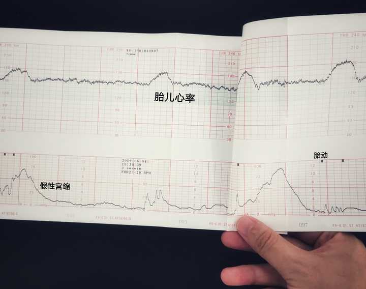 特别担心她是不是会缺氧窘迫什么的(我妈说32-34周是活跃期,之后就