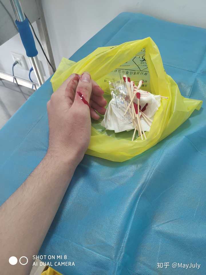 校医院包扎一下就差不多了" 护士给我包扎消毒然后让我去海淀医院缝针