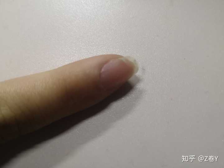 甲床过短应该如何变长?