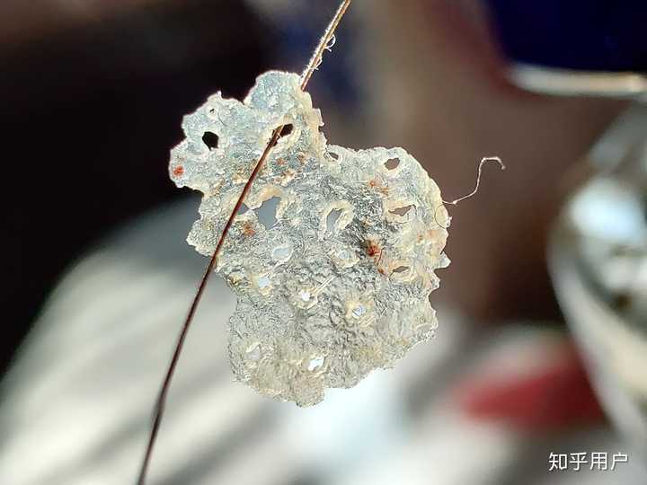 见过的最大头皮屑多大?