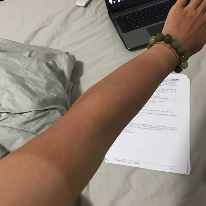 很容易晒黑和很不容易晒黑是一种怎样的体验?