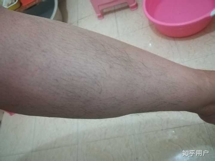 女生体毛旺盛是什么样的体验?