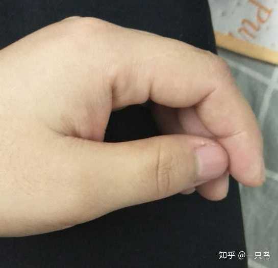 皮肤天生黑黄怎么变白呢?