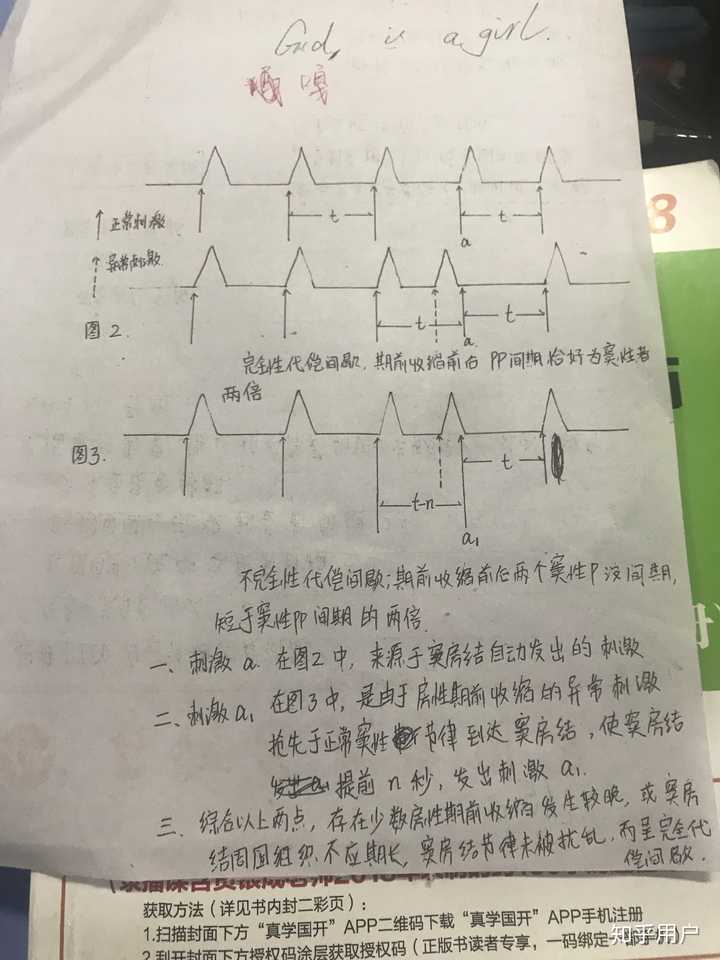 到底什么叫作完全代偿间歇?