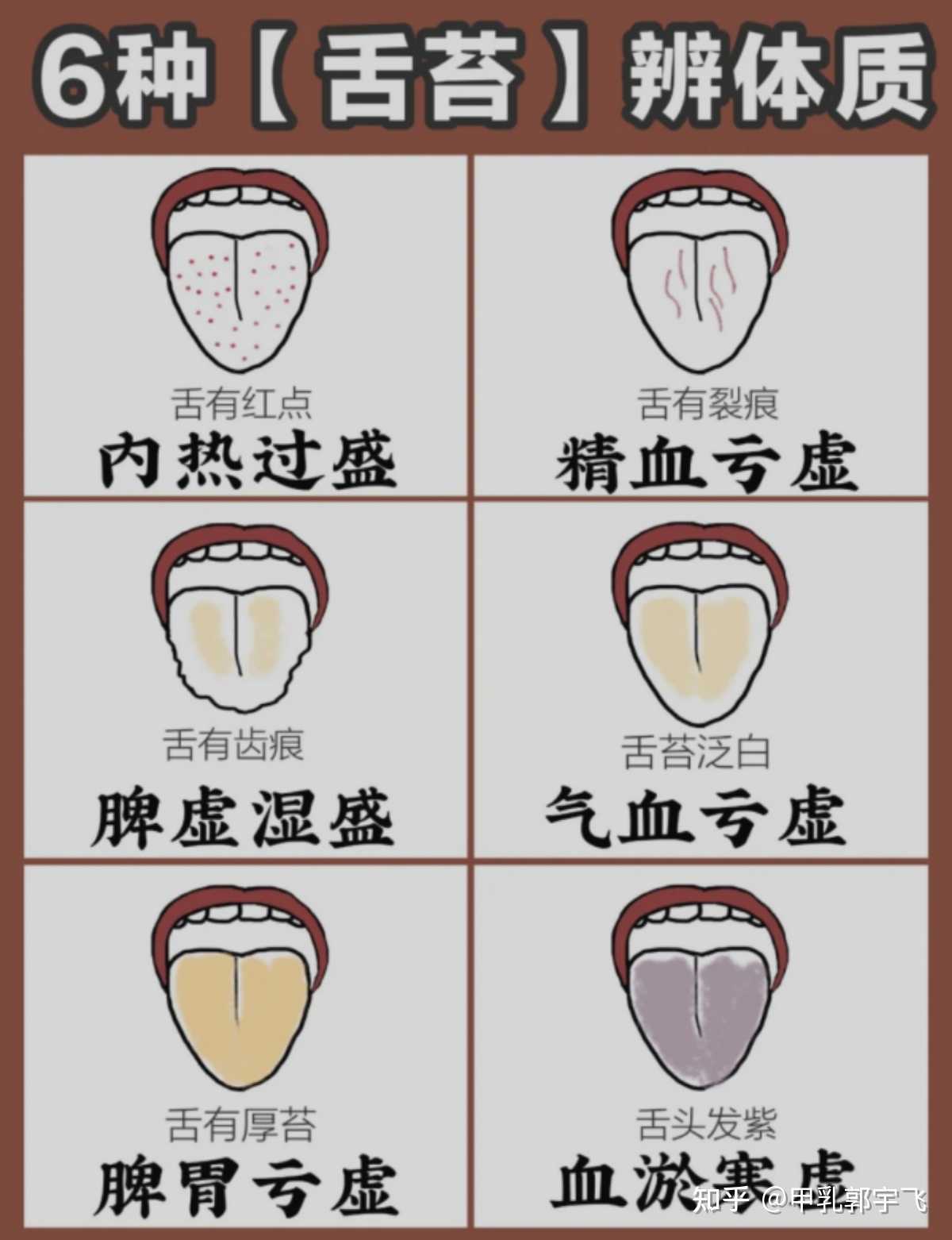 观舌苔辨体质出现这6种情况你得注意