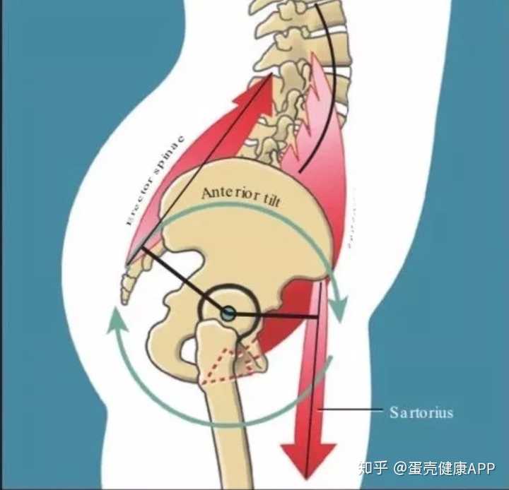 腰间盘突出有哪些好的治疗方法?