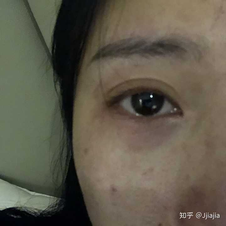 抑郁的人眼神都很空洞吗?