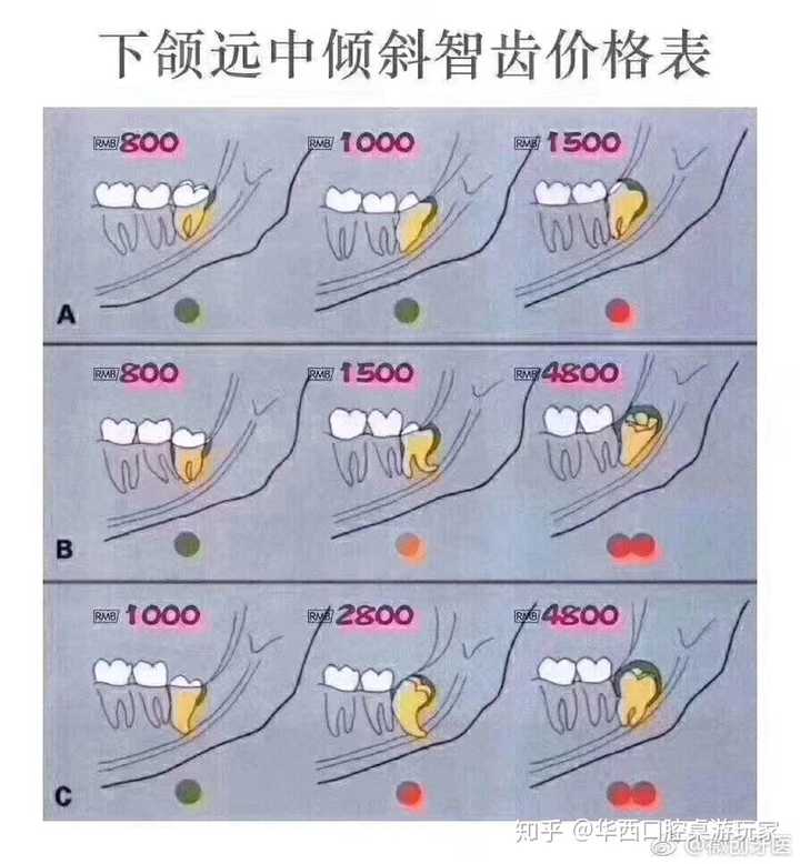 倒置阻生不住院也大于4800了