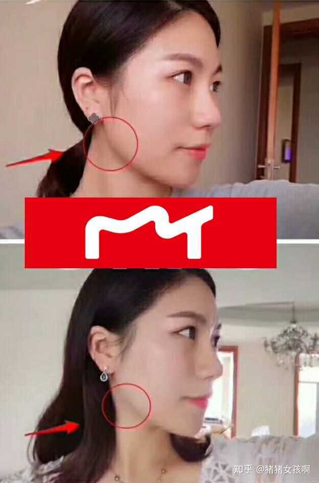 按摩咬肌多久才有效果