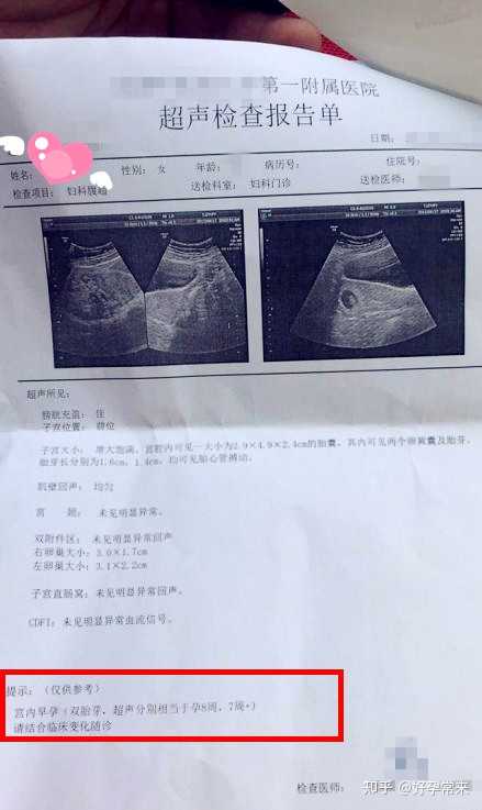 孕8周超声宫内早孕双胎芽长分别为16cm14cm可见胎心管搏动接好孕咯