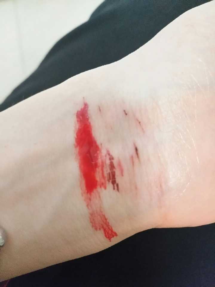 抑郁症的表现有什么?