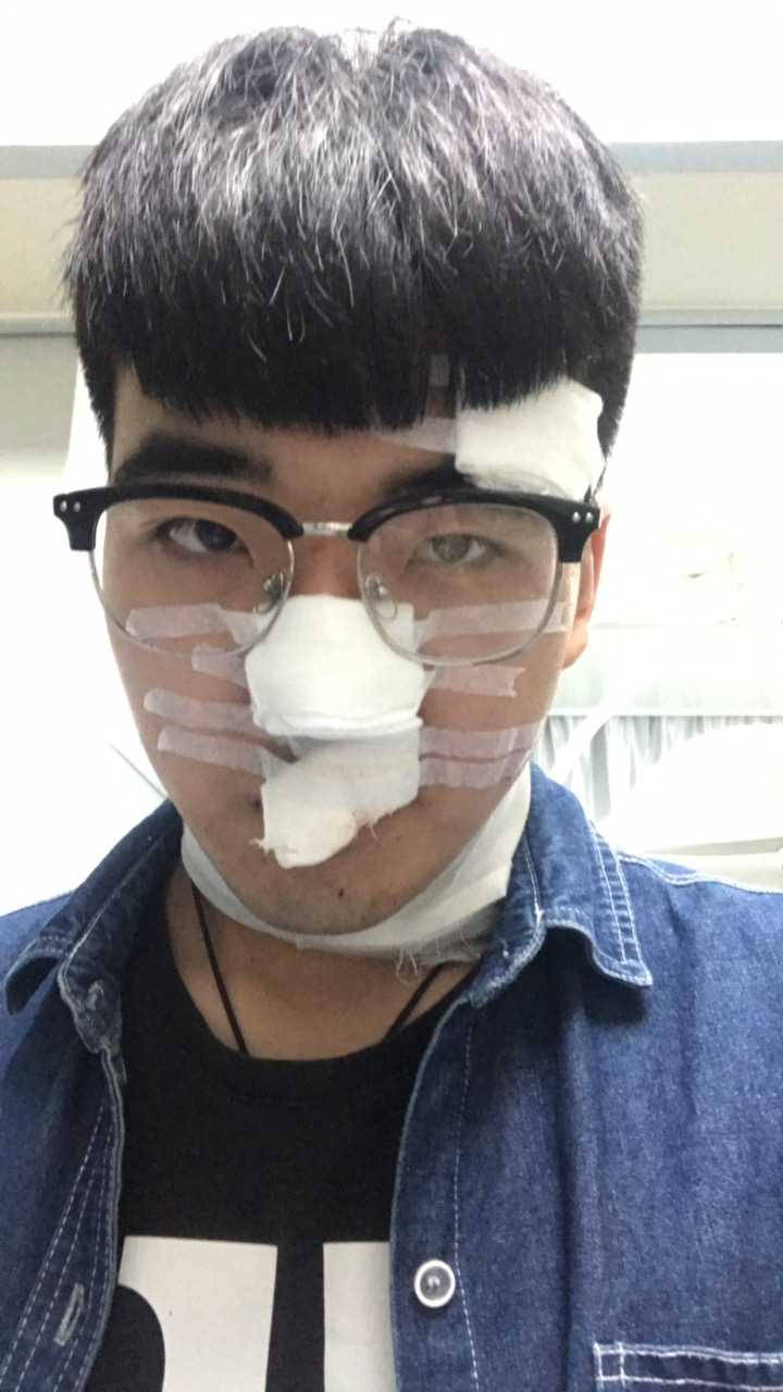 缝针和拆线可怕吗?疼吗?你们当时怕吗?