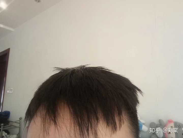 大家最失败的理发是什么?