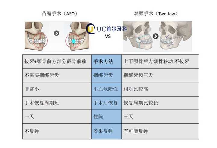 正颌手术一般费用多少?最大的风险是什么?