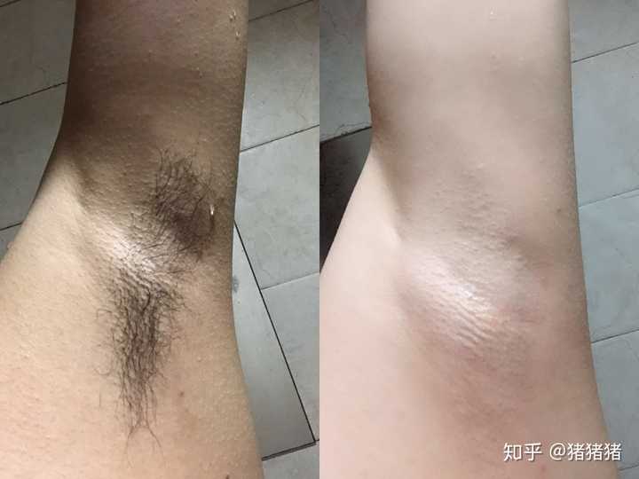 怎样在不引起尴尬的前提下提醒女生剃腋毛?