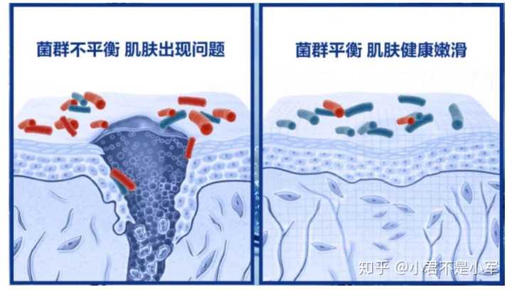 皮肤具体是怎样抵御细菌的?