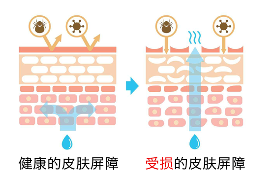 皮肤屏障的"砖墙"模型