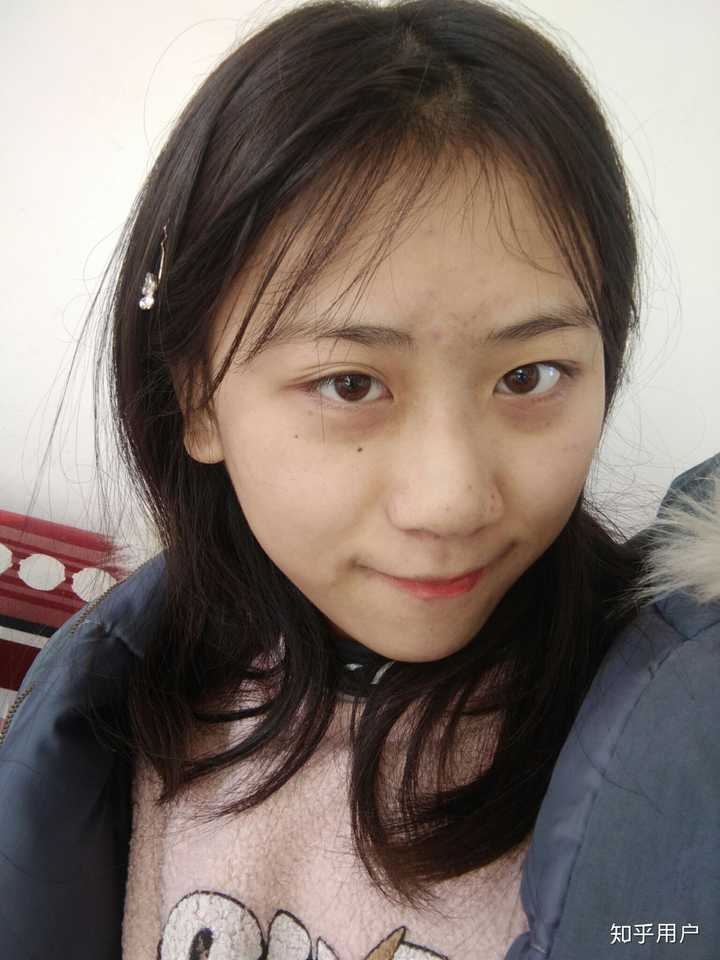 怎么看待五官漂亮但是皮肤差的女性?