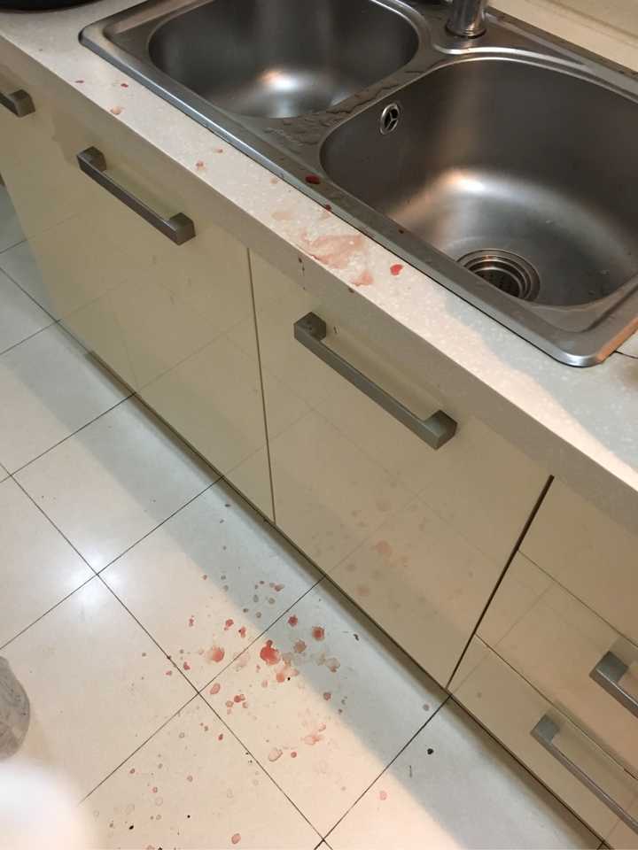 手指被割掉一块肉是什么体验?