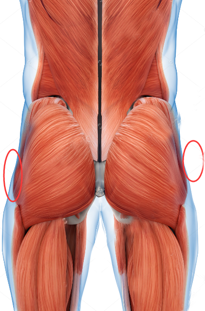 臀部侧面凹陷通常是由于臀部肌群(特别是臀小肌)不发达,且阔筋膜张肌