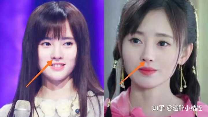 鞠婧祎真的整容了吗?