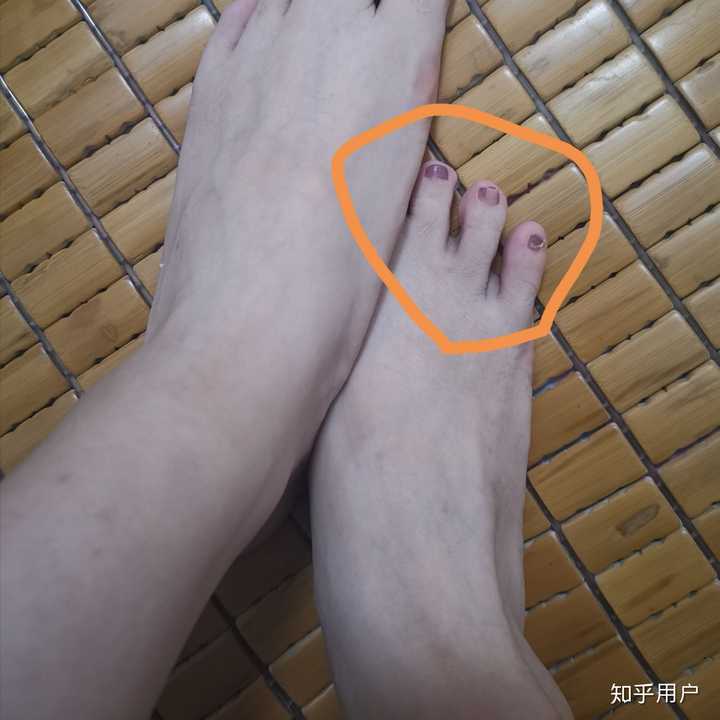 挡掉前面两只脚趾更直观,后三真的很短