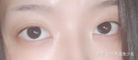 先上图 素眼的情况下 两个眼角都是l型 右眼l型回勾更明显一点 内眦