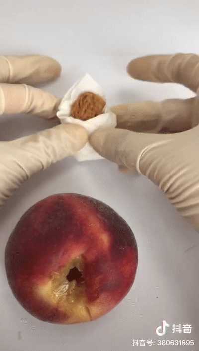 等等,他妈妈不是刚才手术进行侧切了嘛,所以接下来要给他妈妈做缝合