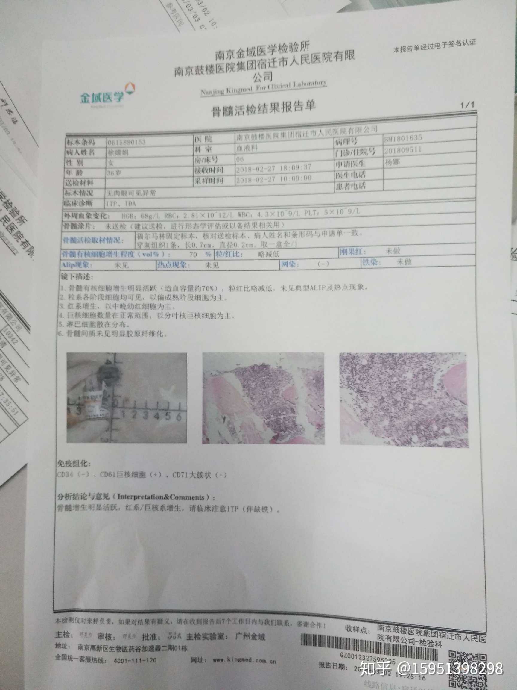 如何治疗原发性血小板减少