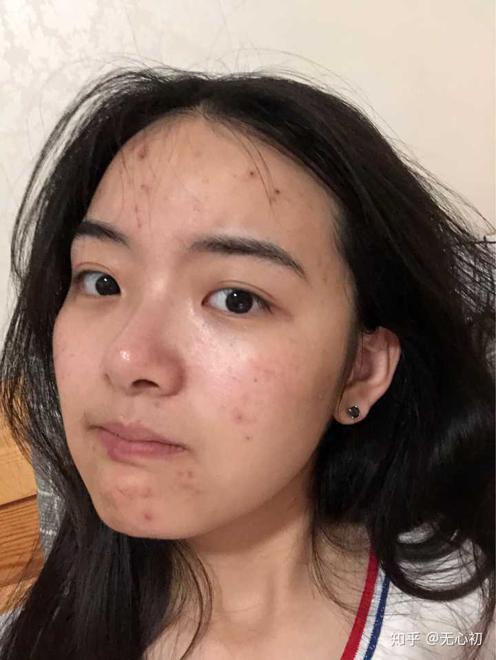 五官好看,皮肤差是什么体验?