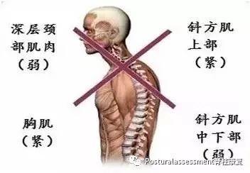 怎样改善圆肩?