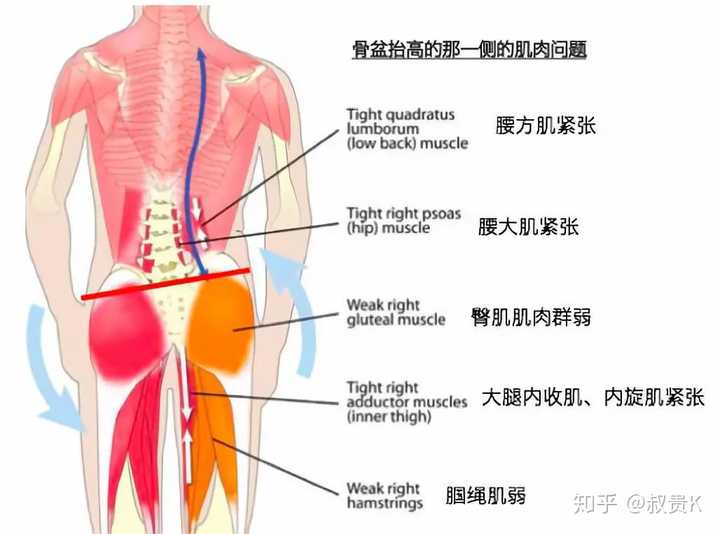 这些不良习惯会慢慢地损伤你的肌肉,影响体态,最终造成「骨盆倾斜」