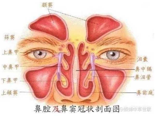 得鼻窦炎是什么体验?