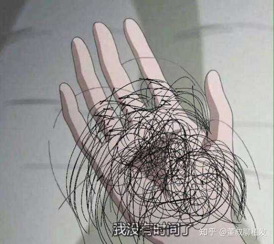 女生脱发应该用哪种洗发水?