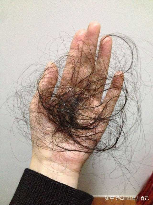 我媳妇掉头发怎么办.生完孩子头发一抓一大把.