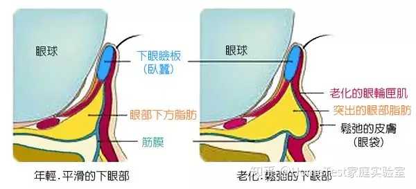 眼霜是智商税吗