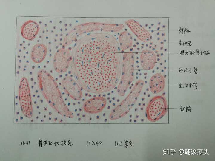 为什么咱们不弄个病理红蓝手绘图的问题呢?