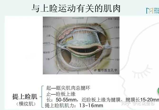 请问我这个算不算上眼睑下垂?