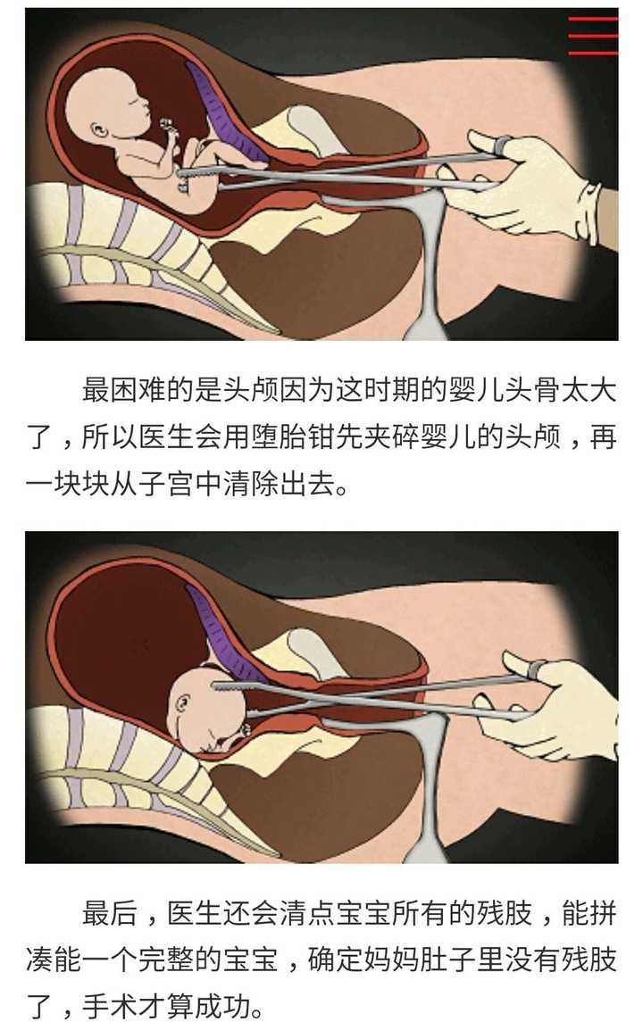 你见过哪些看着就疼的操作?