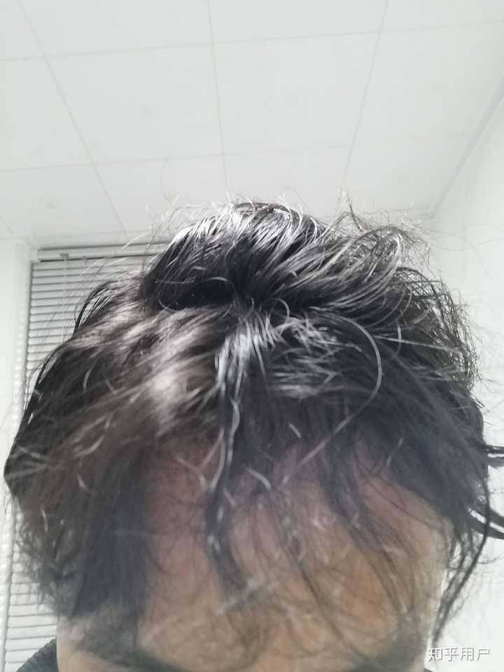 男生烫钢夹烫是什么样的体验?