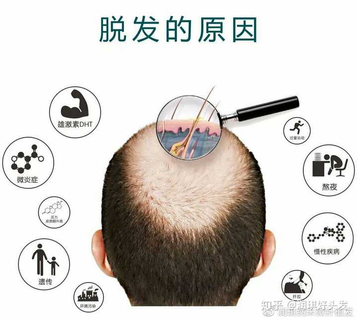 听说植发很厉害,是不是植发可以解决所有脱发的问题呀