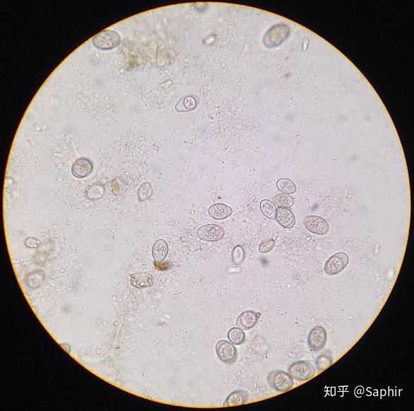 显微镜下的球虫卵囊