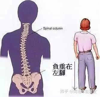 确认脊柱侧弯的角度. 找到专业的制定脊柱矫正训练方案.